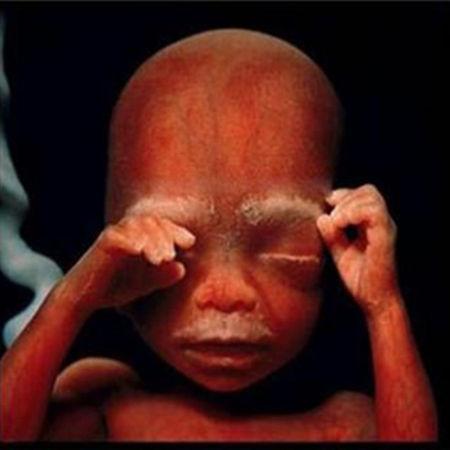 第三代代孕宝宝为什么总是摇头